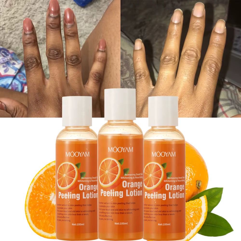 Lotion peeling