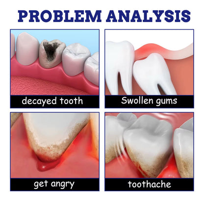 Toothpaste spray for cavity pain
