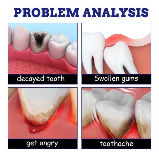 Toothpaste spray for cavity pain