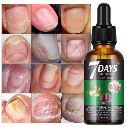 Antifungal serum