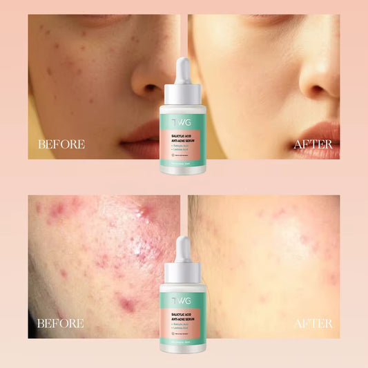 sérum acide salicylique twg