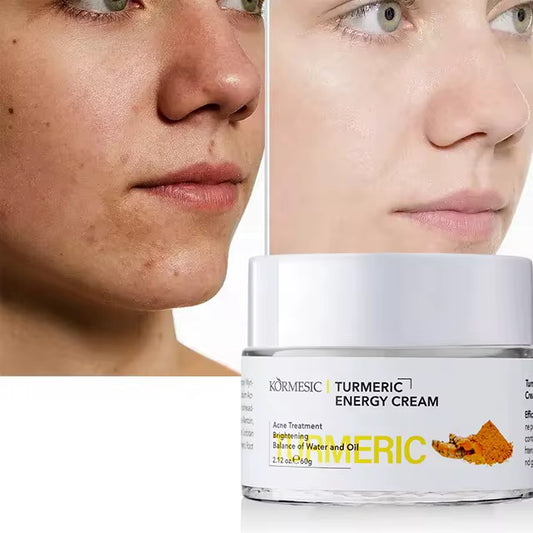 Turmeric face cream for treatment and repair