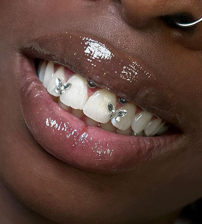 Tooth gems (diamond)