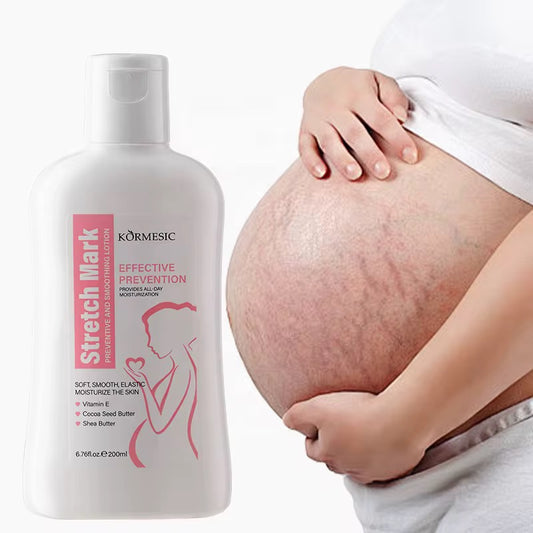 Lotion contre les vergetures