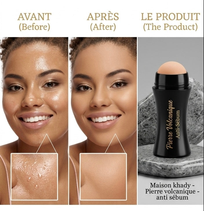 Volcanic stone - anti-sebum