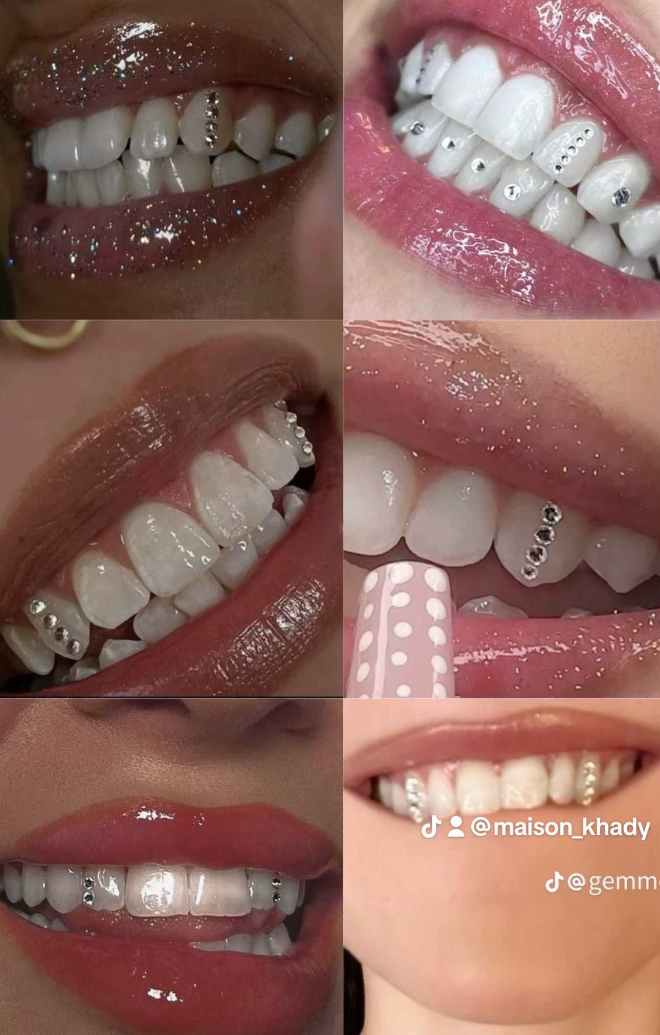Tooth gems (diamond)