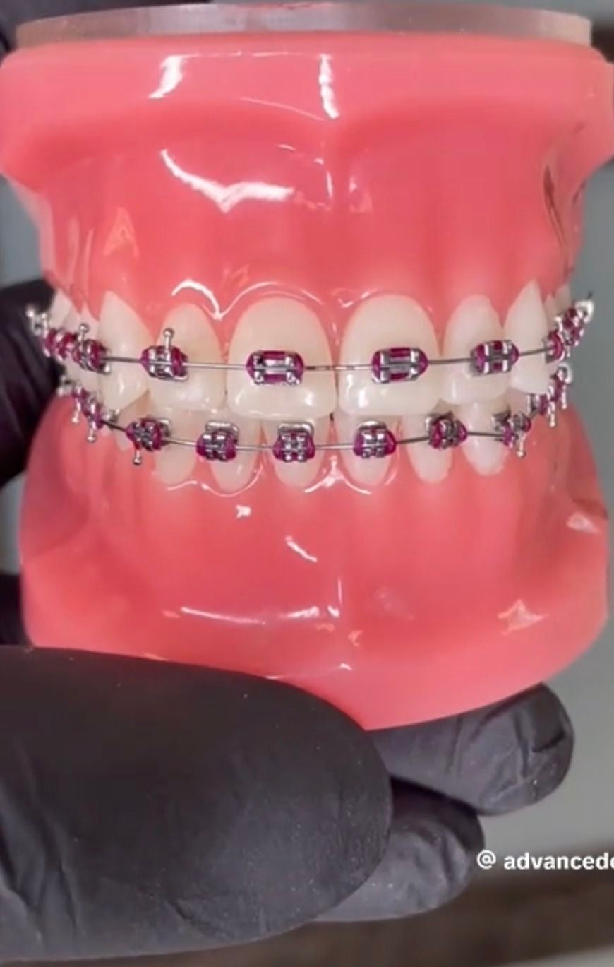 False teeth