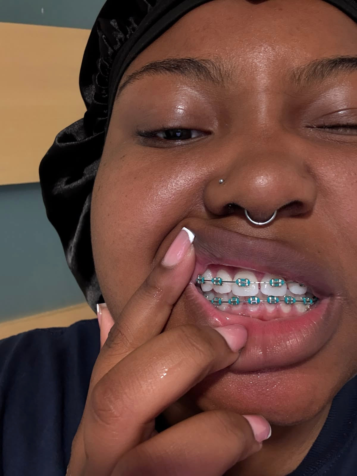False teeth