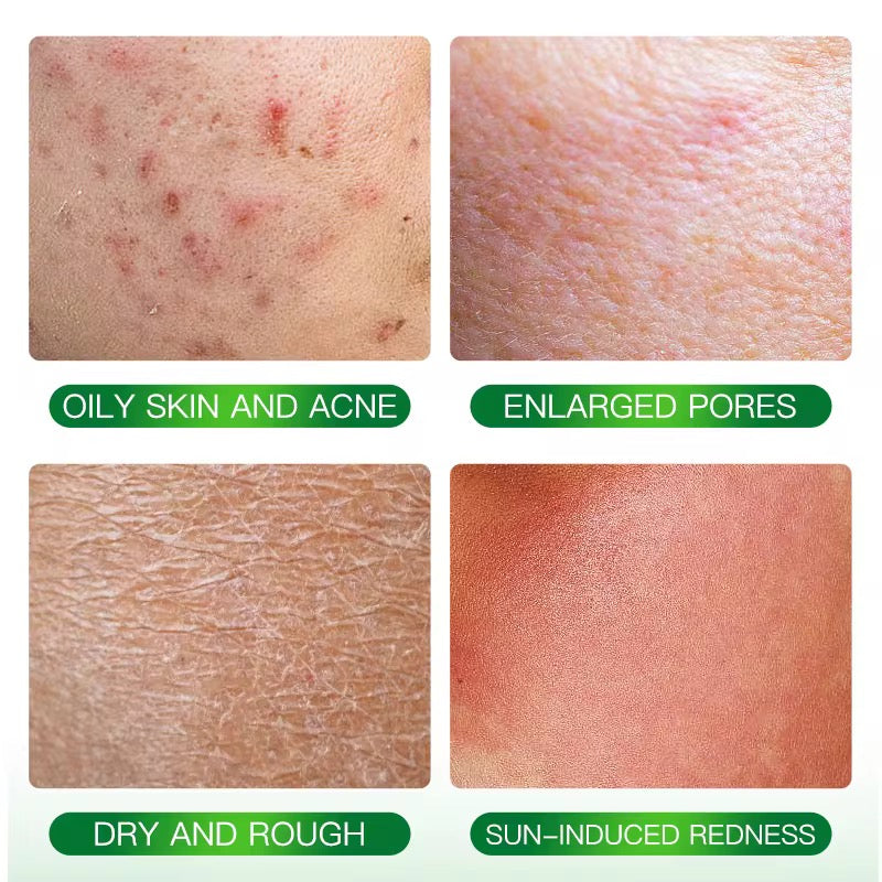 Gel apaisant aloe Vera