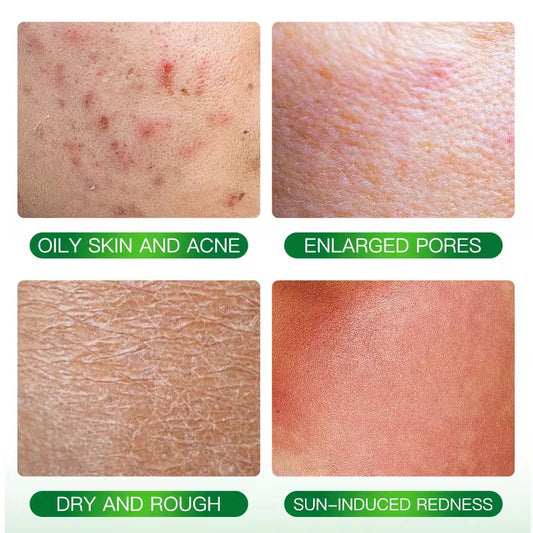 Soothing Aloe Vera Gel