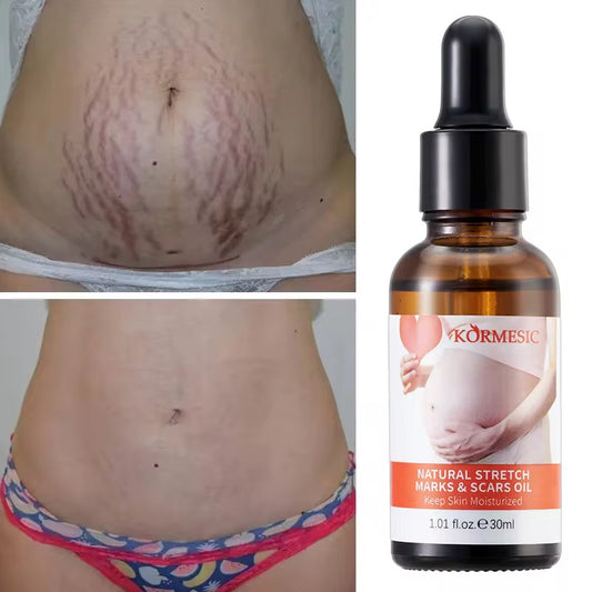 Huile vergetures stretch Marks & Scars Oil